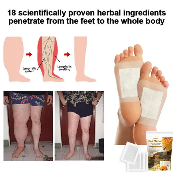 Bee Venom Lymphatic Drainage Foot Patches 10 patches